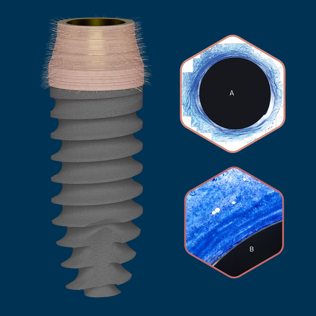 Krčková časť PRAMA