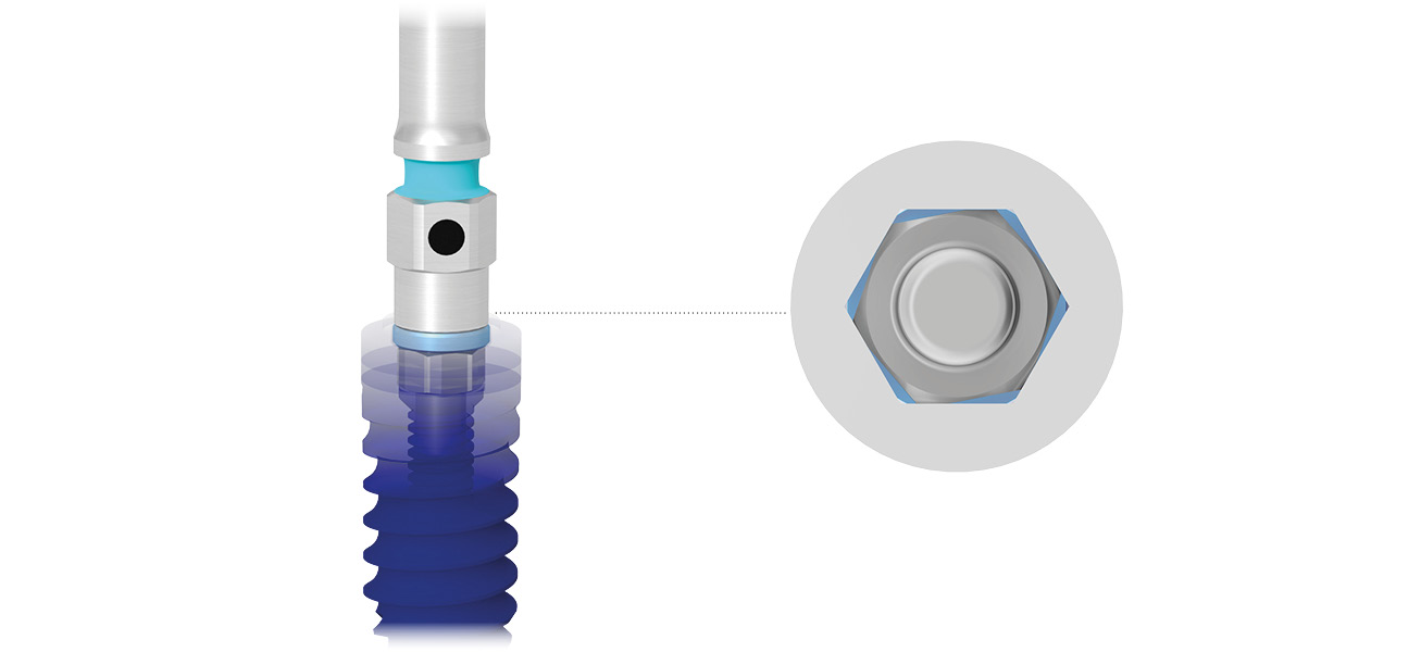 CSR implants overview row